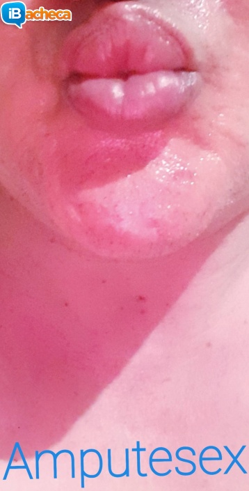 Immagine 3 - Amputesex