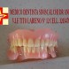Ribasatura Immed Dentiere - immagine 1